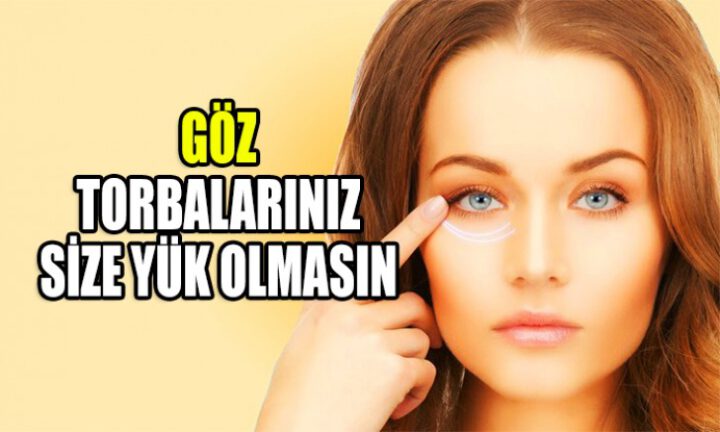 Göz torbalarınız size yük olmasın!