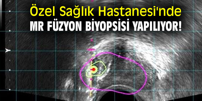 Özel Sağlık Hastanesi’nden 100’üncü MR Füzyon Biyopsisi