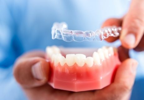 Invisalign ile Konforlu Bir Tedavi Mümkün