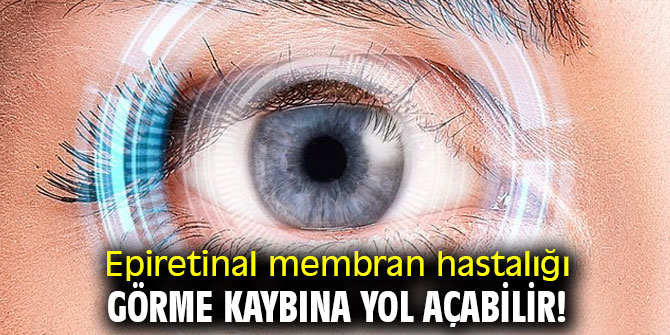 Epiretinal membran hastalığı görme kaybına yol açabilir!